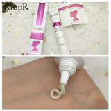 RtopR Acne Scar Stretch Marks Remover Cream Skin Repair Face Cream Acne Spots Acne Treatment Blackhead Whitening Cream Skin Care