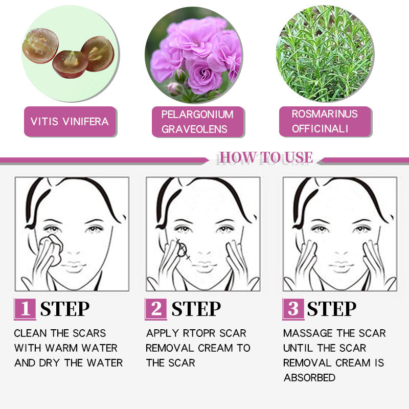 RtopR Acne Scar Stretch Marks Remover Cream Skin Repair Face Cream Acne Spots Acne Treatment Blackhead Whitening Cream Skin Care