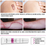 RtopR Acne Scar Stretch Marks Remover Cream Skin Repair Face Cream Acne Spots Acne Treatment Blackhead Whitening Cream Skin Care