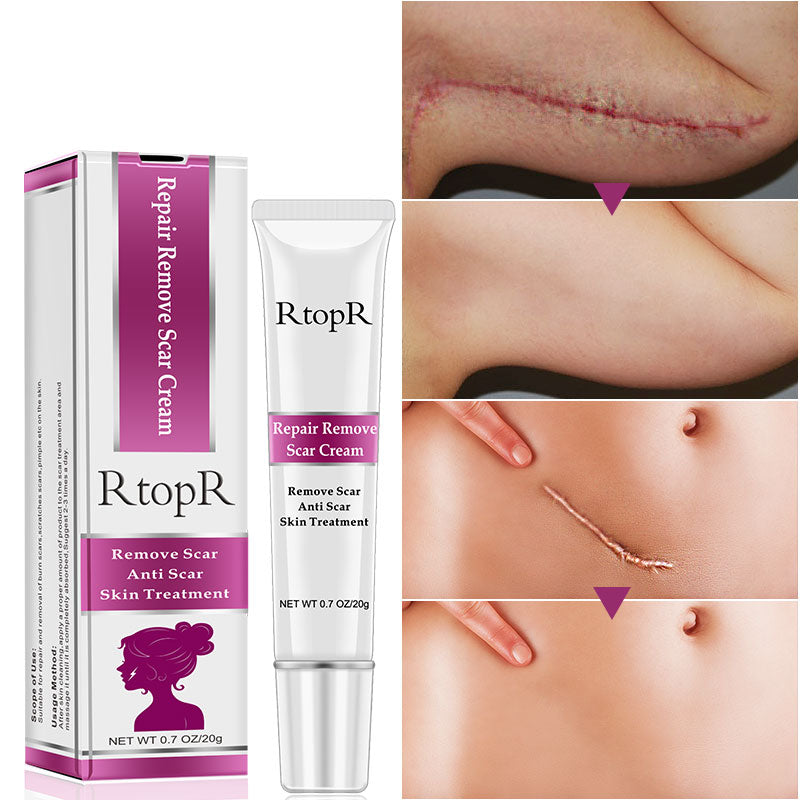 RtopR Acne Scar Stretch Marks Remover Cream Skin Repair Face Cream Acne Spots Acne Treatment Blackhead Whitening Cream Skin Care