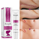 RtopR Acne Scar Stretch Marks Remover Cream Skin Repair Face Cream Acne Spots Acne Treatment Blackhead Whitening Cream Skin Care